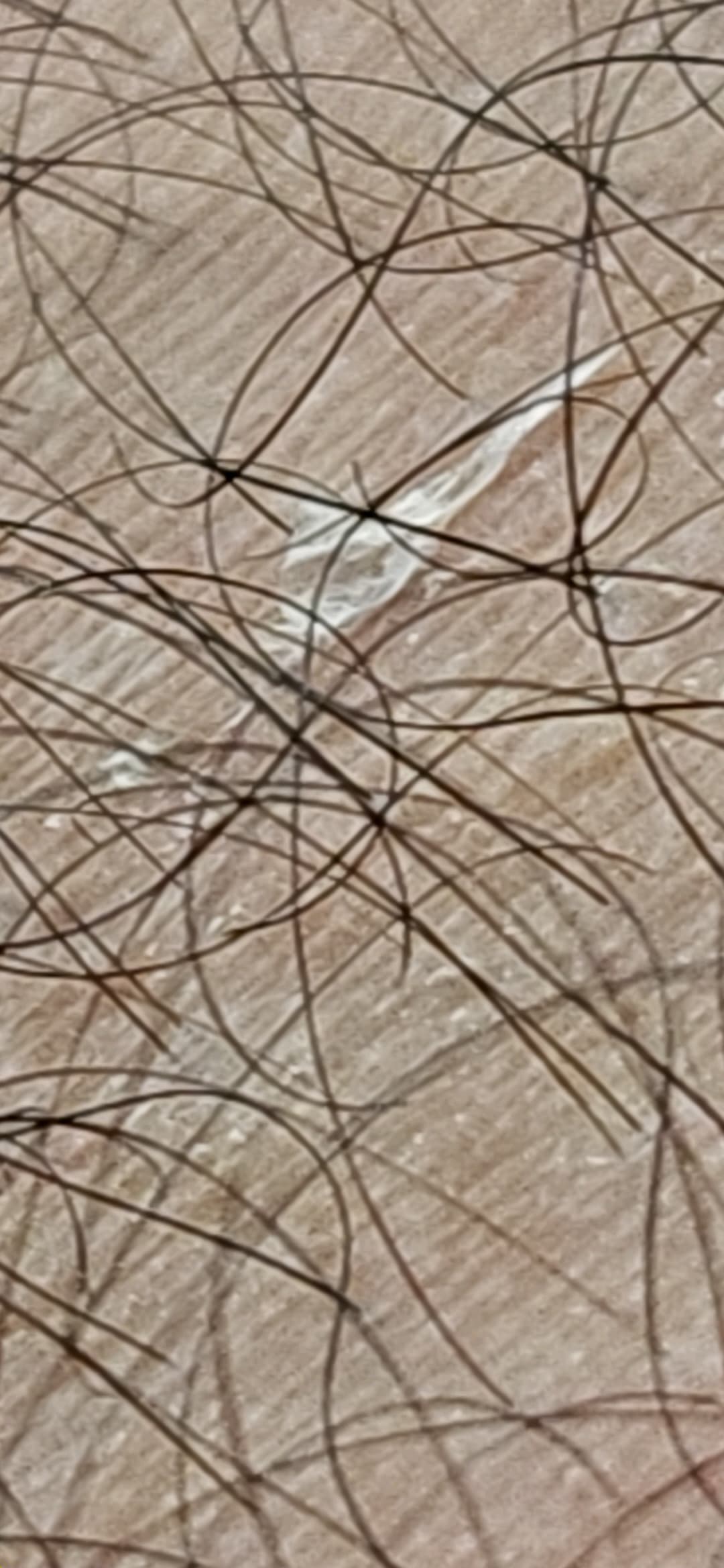 1000028090