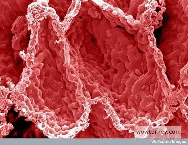 Akciğerdeki alveoller