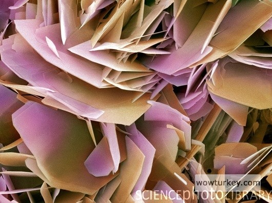 Böbrek taşı kristalleri..