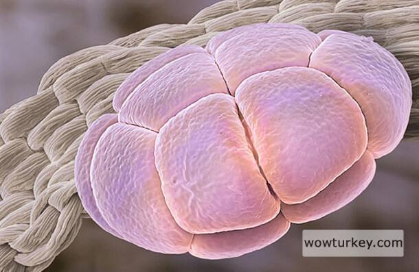 Bu polenler ipek ağacına ait.