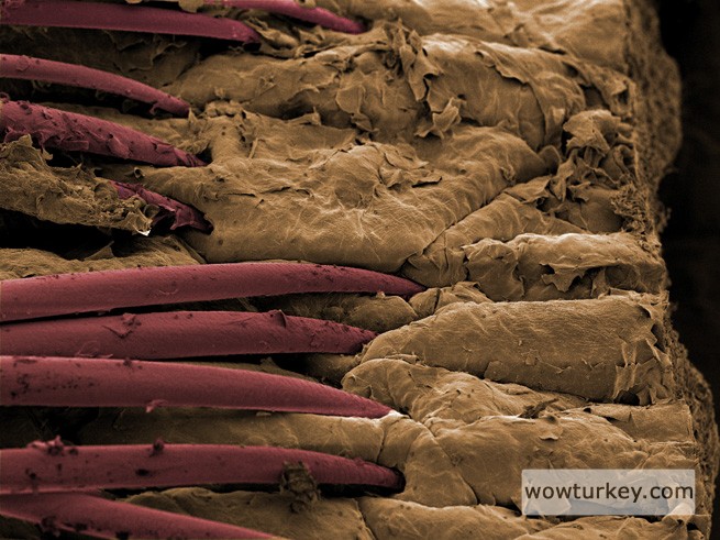 Deriden çıkan kıllar..