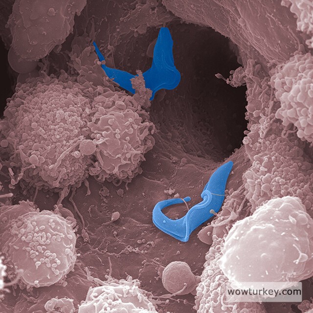 trpanosomes Trypanosoma brucei (blue), which causes sleeping sickness, in the liver of an infected mouse