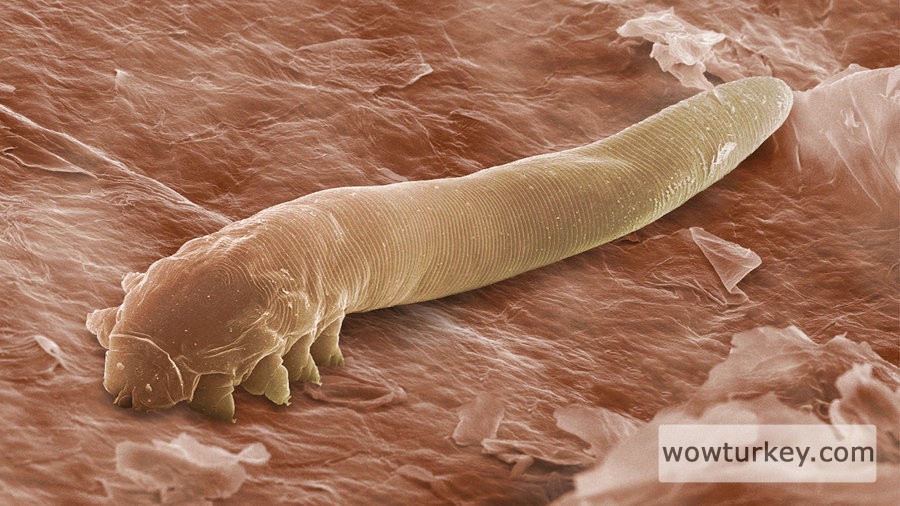 Zararsız akar Demodex folliculorum bir elektron mikroskobu görüntüsünde burada görülen, kirpik köklerinin yaşıyor.